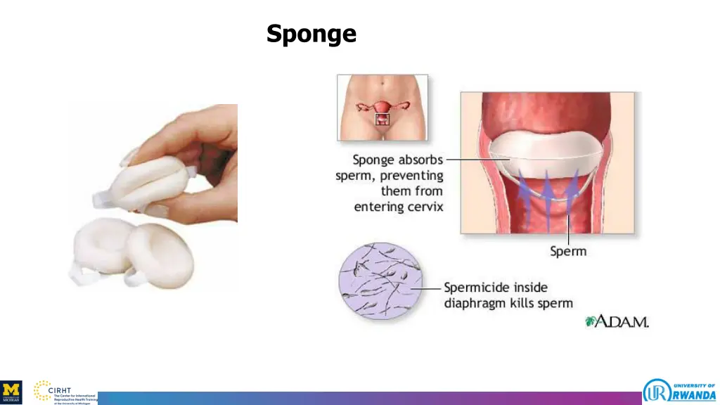 sponge