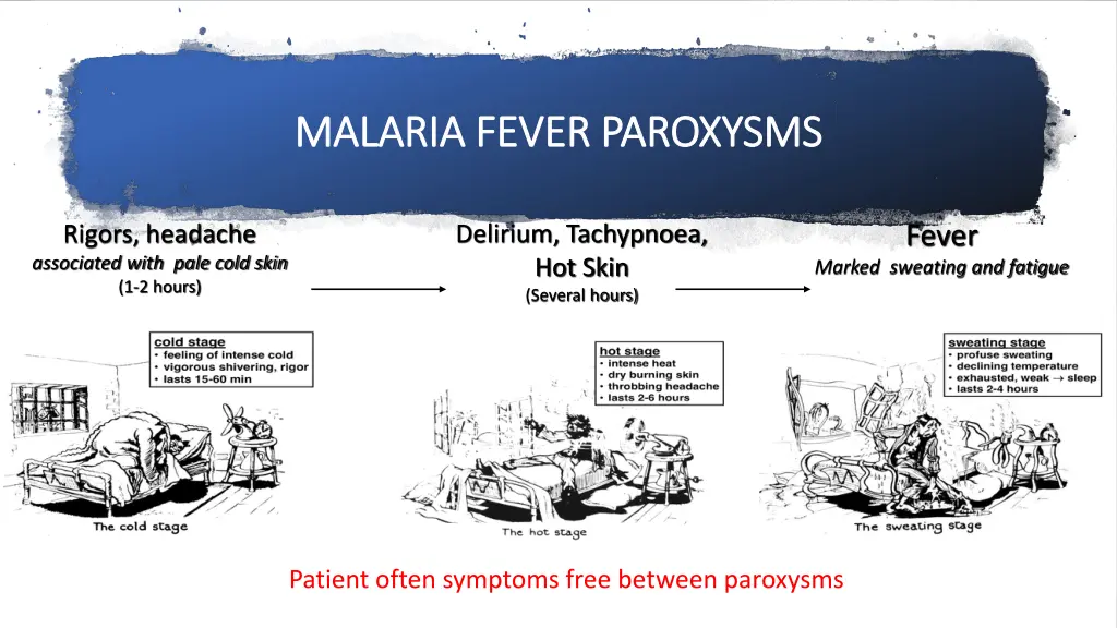 malaria fever paroxysms malaria fever paroxysms