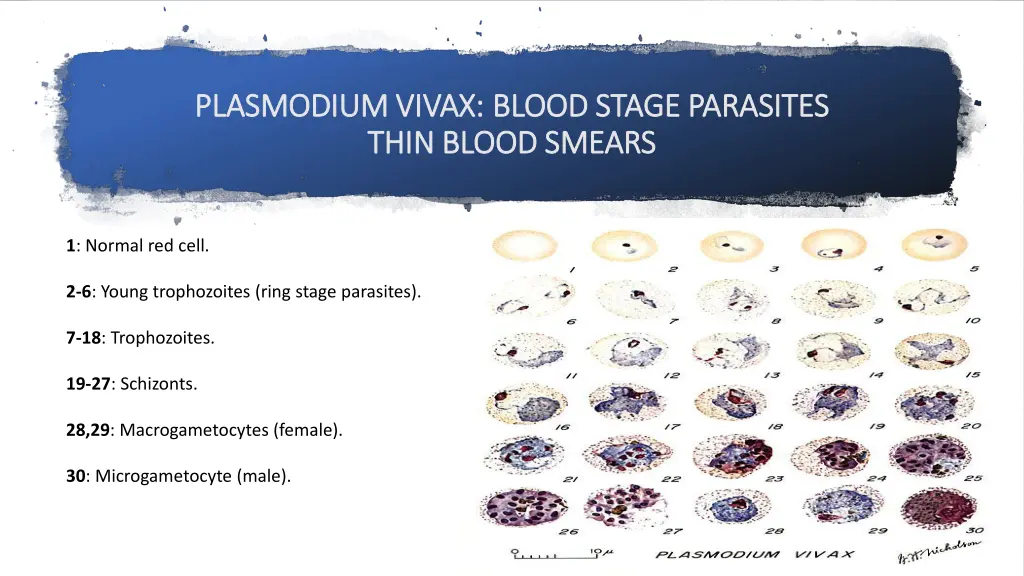 plasmodium vivax plasmodium vivax blood stage