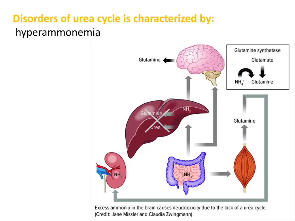 disorders of urea cycle is characterized