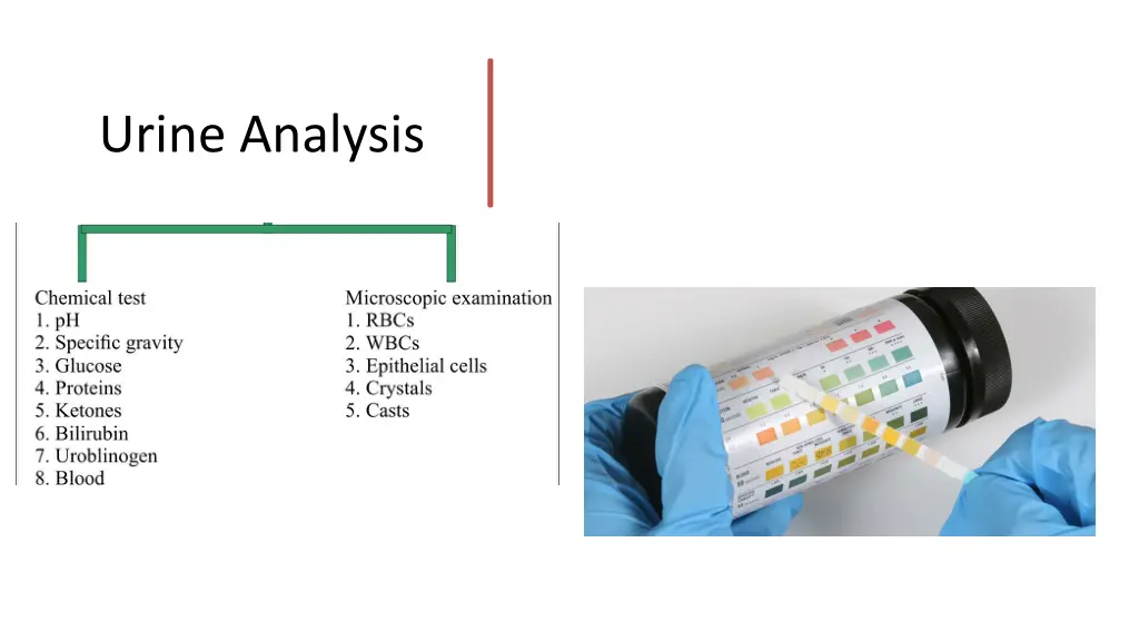 urine analysis 1