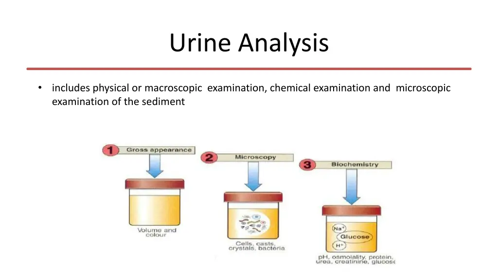 urine analysis