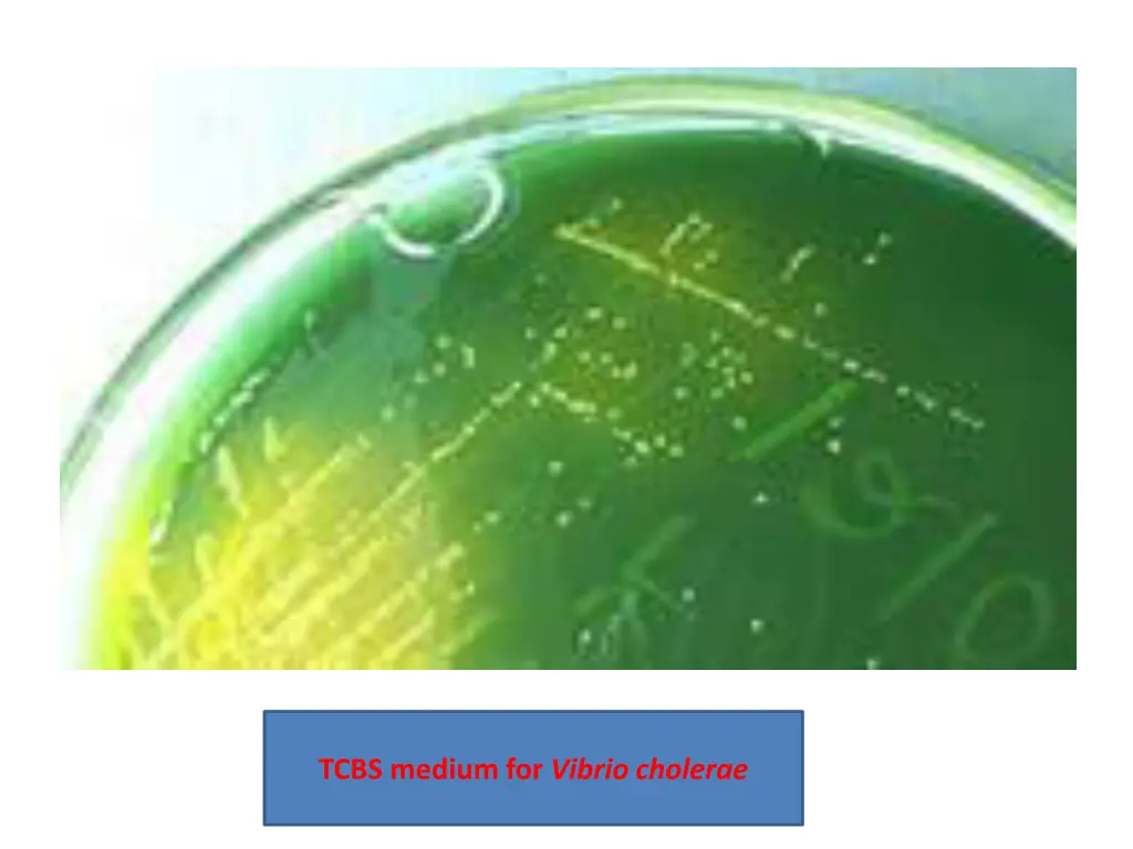 tcbs medium for vibrio cholerae