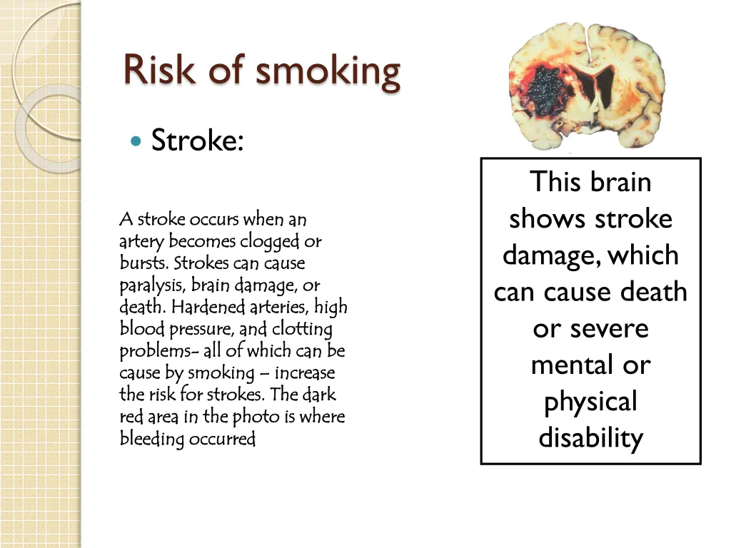 risk of smoking 13