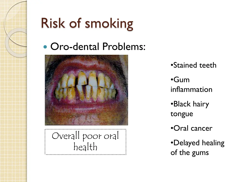 risk of smoking 5