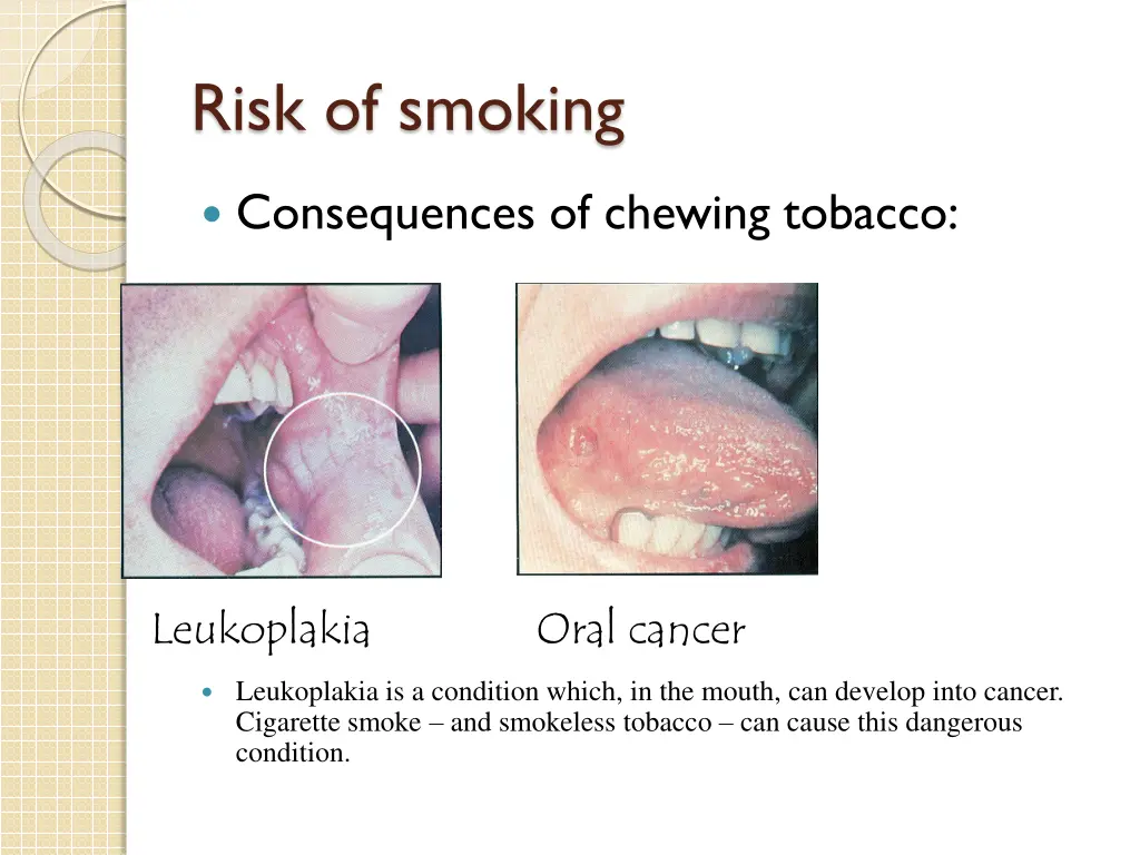 risk of smoking 6