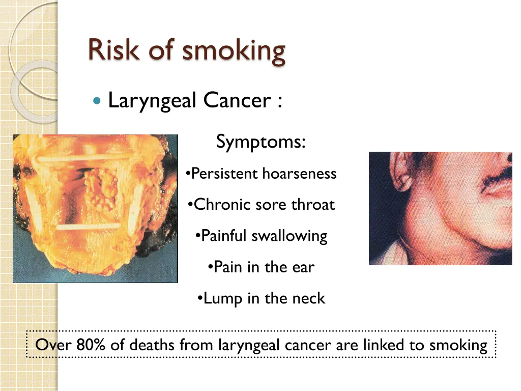 risk of smoking 7