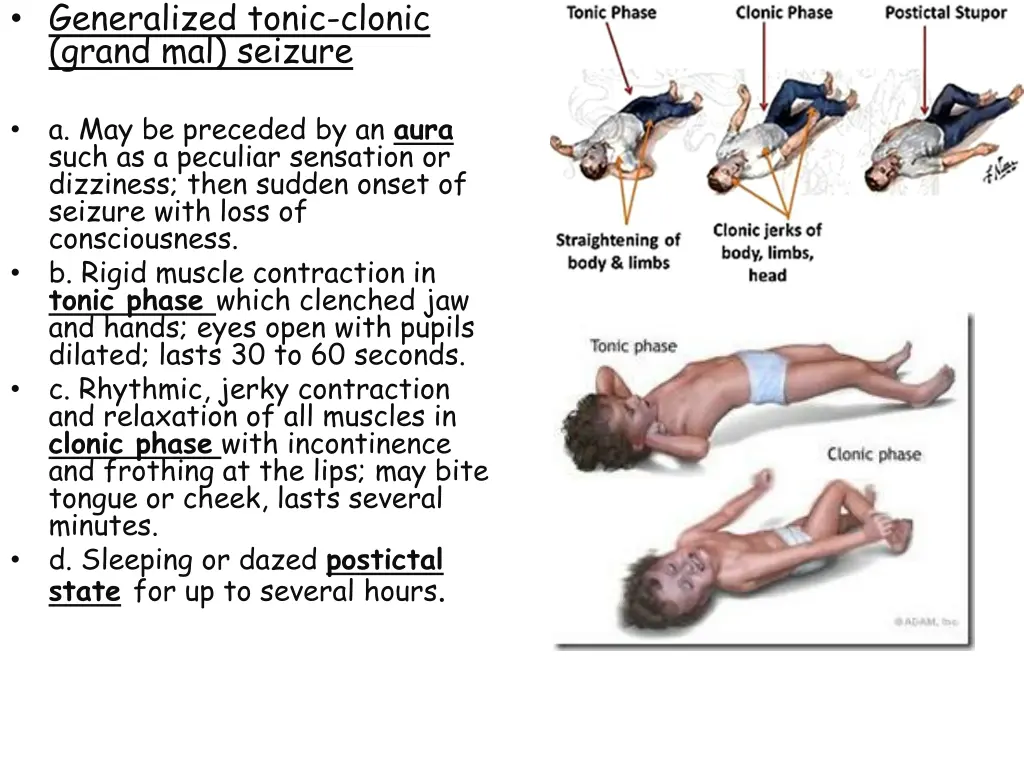 generalized tonic clonic grand mal seizure