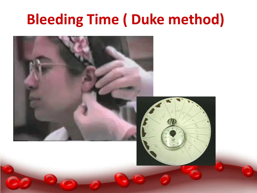 bleeding time duke method