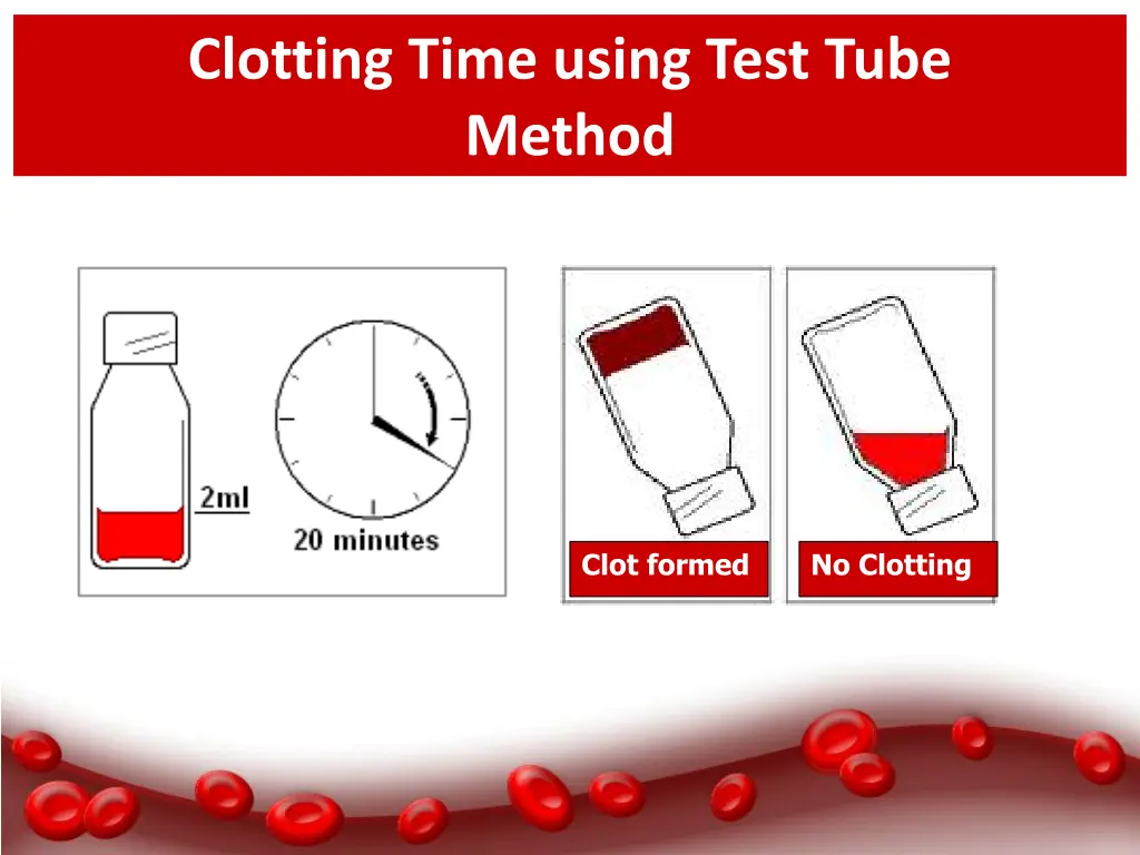 clotting time using test tube method 1