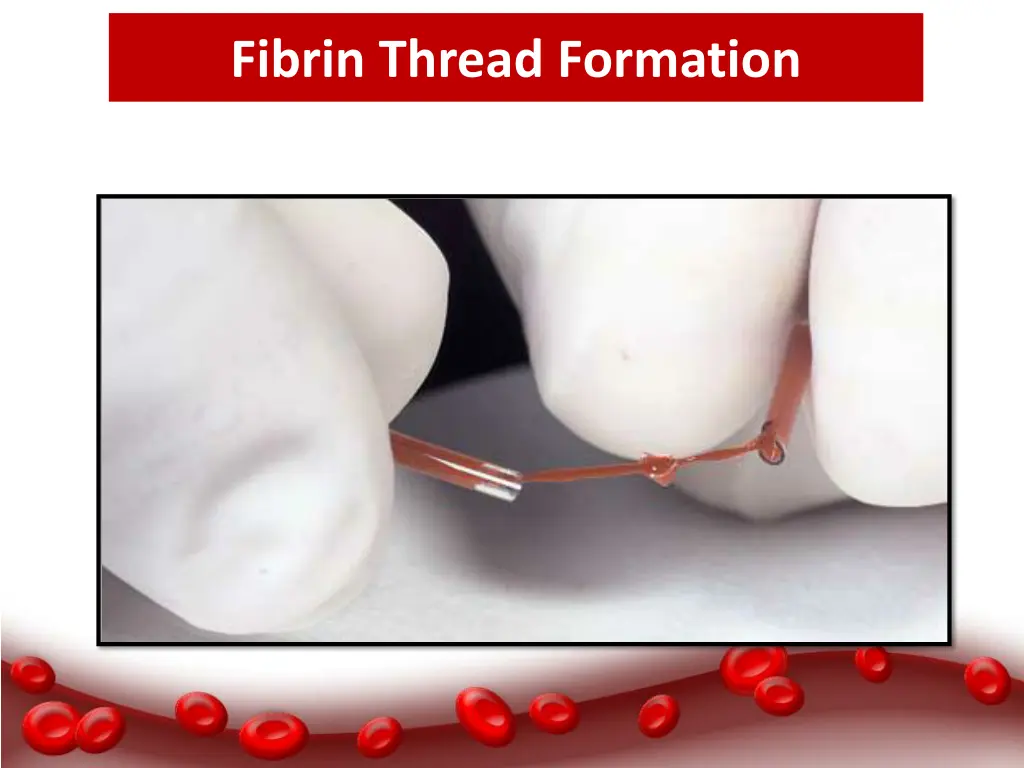 fibrin thread formation