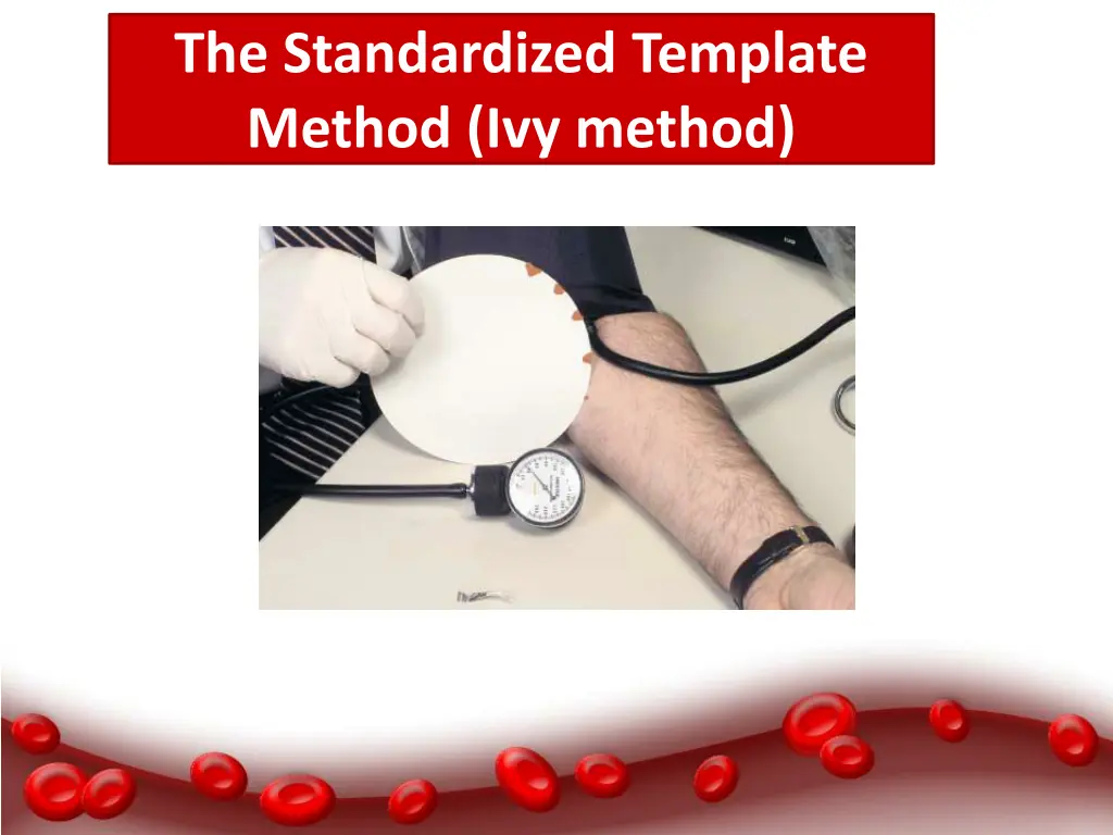 the standardized template method ivy method 1