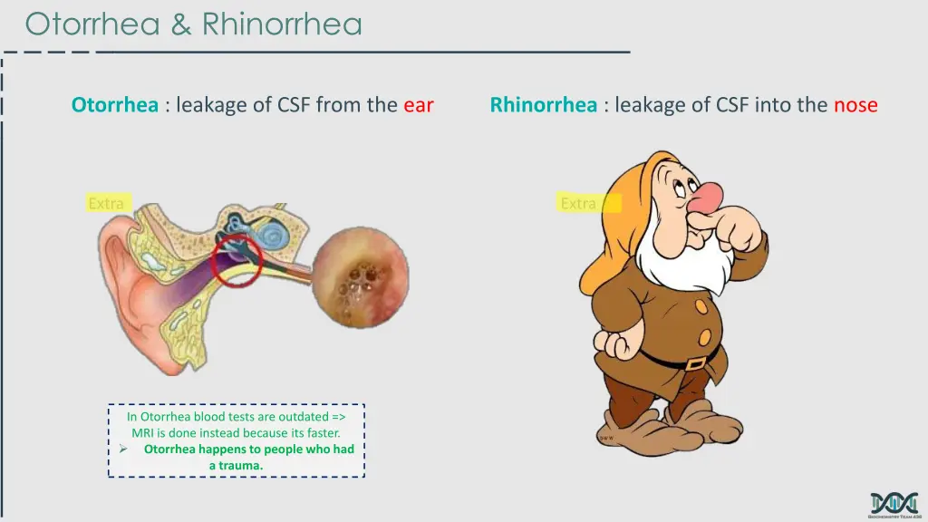 otorrhea rhinorrhea