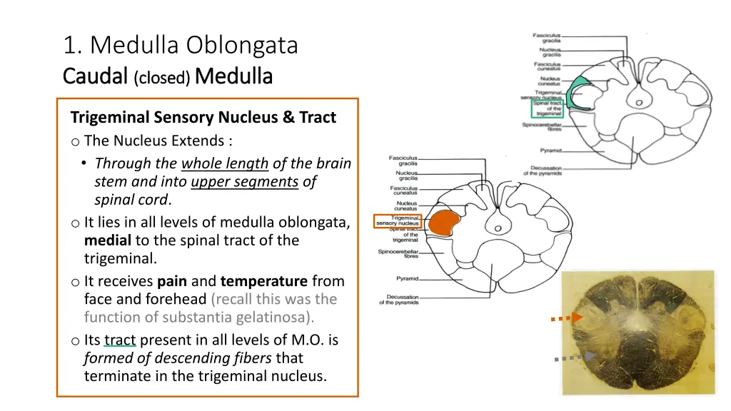 1 medulla oblongata caudal caudal closed closed 1