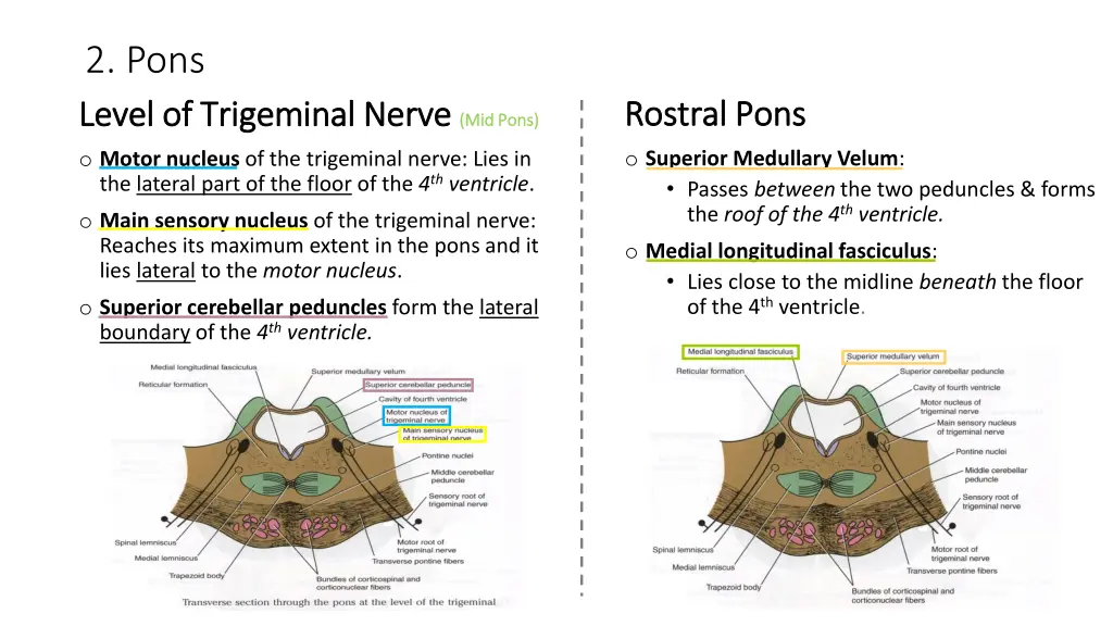 2 pons level of trigeminal nerve level