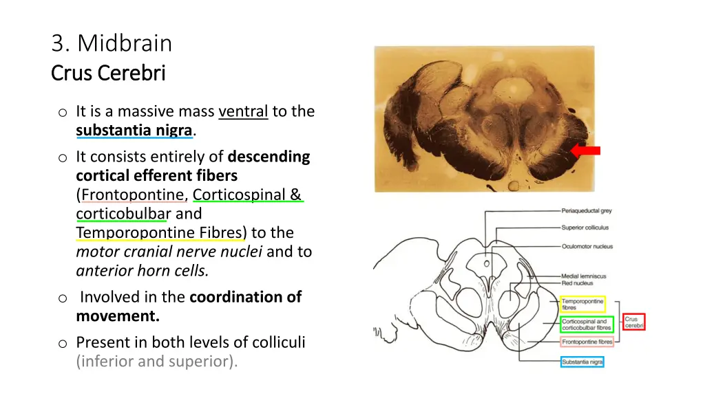 3 midbrain crus crus cerebri cerebri