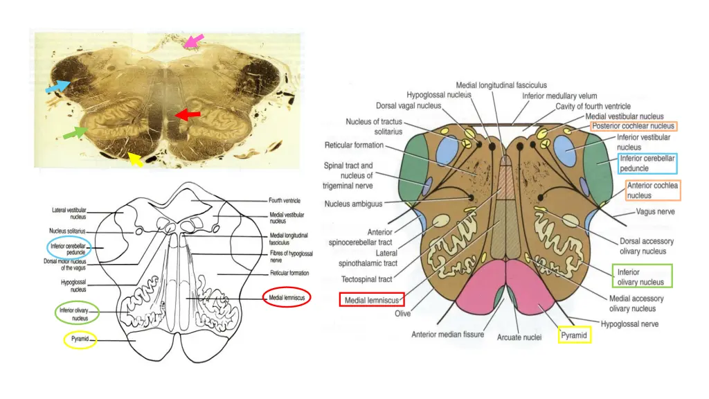 slide9