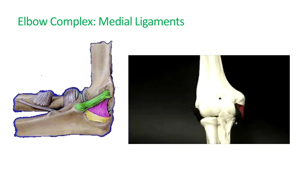 elbow complex medial ligaments