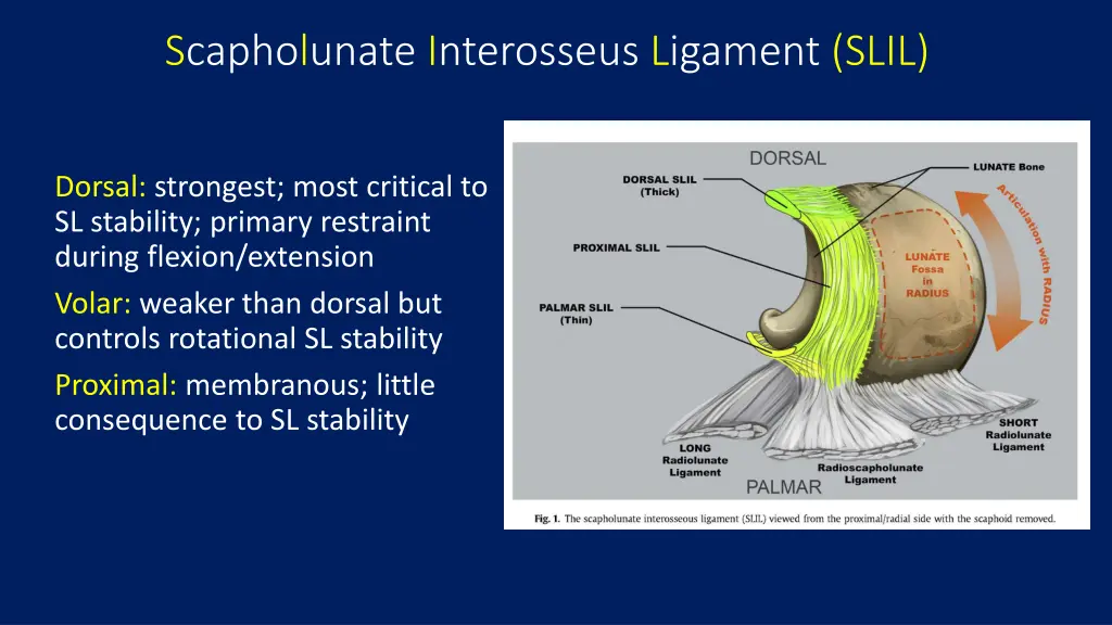 scapholunate interosseus ligament slil