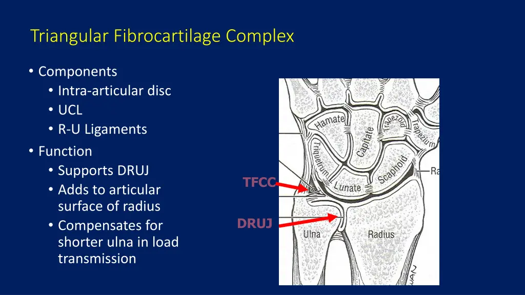 triangular fibrocartilage complex