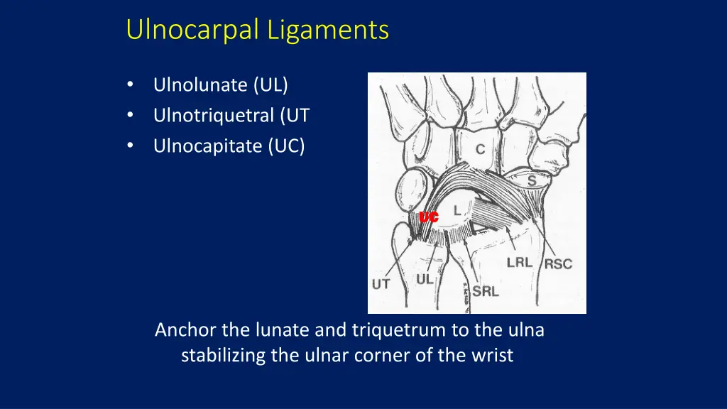 ulnocarpal ligaments