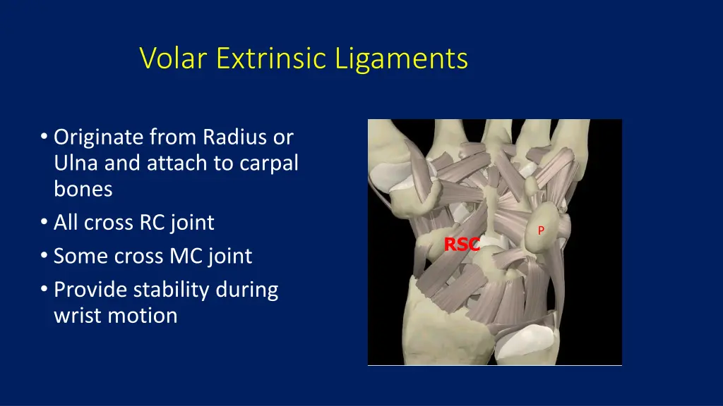 volar extrinsic ligaments