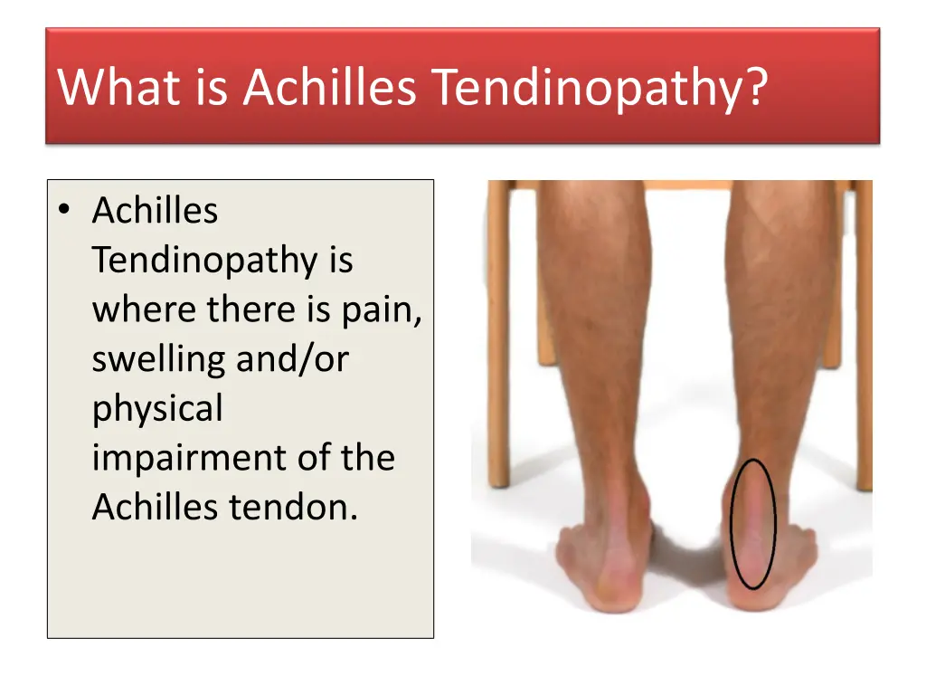 what is achilles tendinopathy