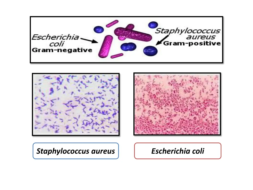 staphylococcus aureus