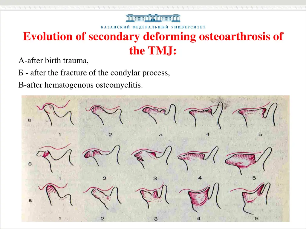 evolution of secondary deforming osteoarthrosis