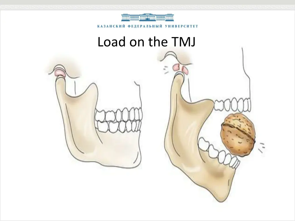 load on the tmj