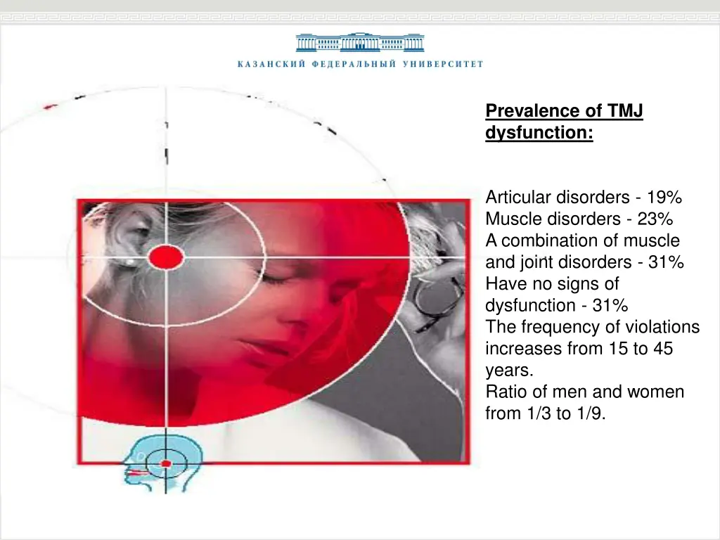 prevalence of tmj dysfunction