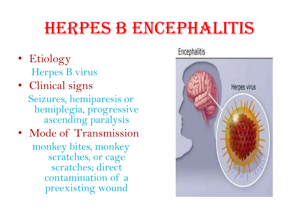 herpes b encephalitis