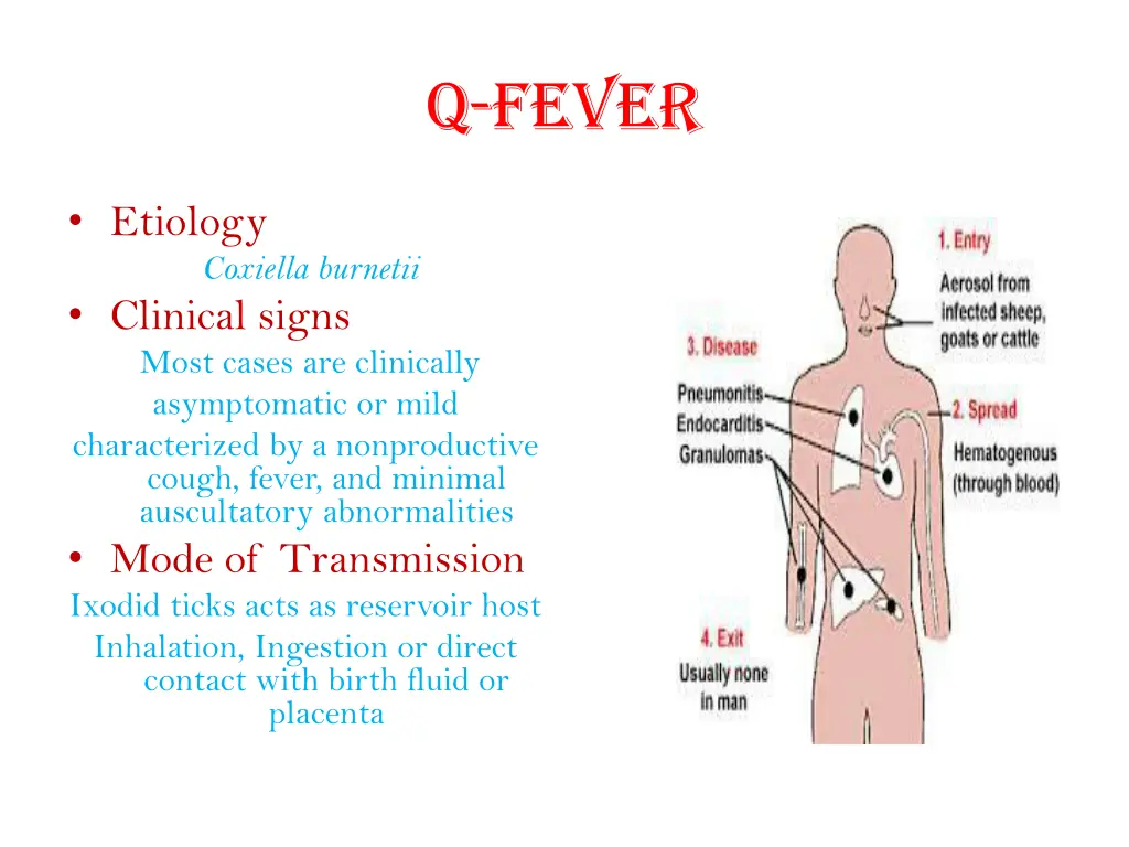 q fever