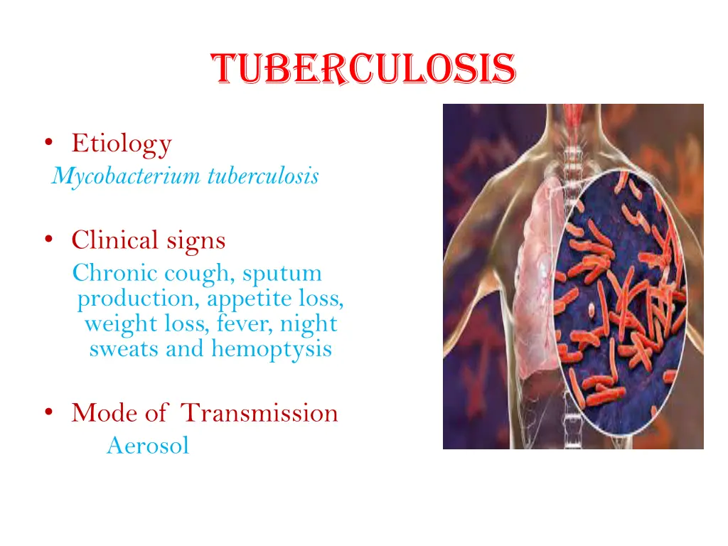 tuberculosis