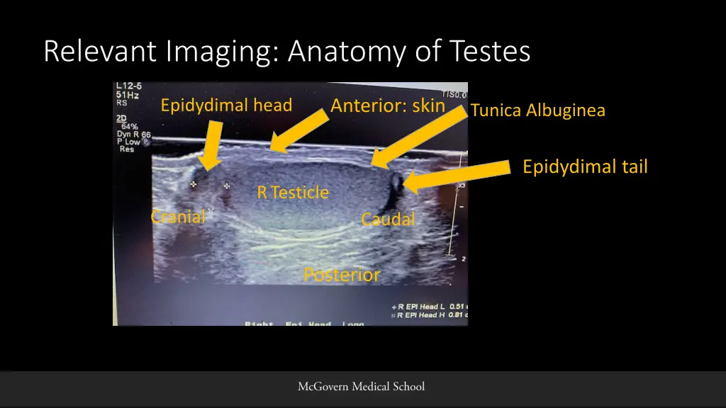 relevant imaging anatomy of testes