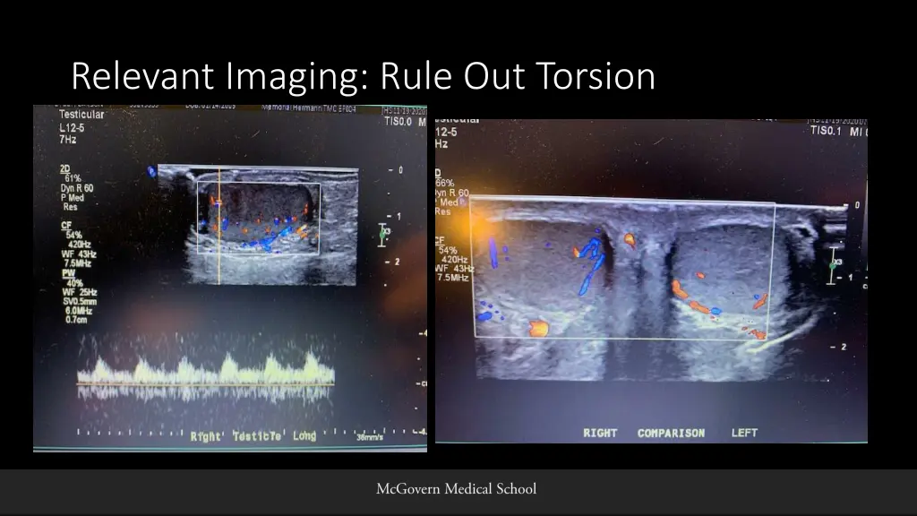 relevant imaging rule out torsion