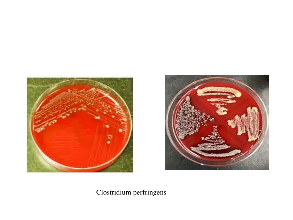 clostridium perfringens