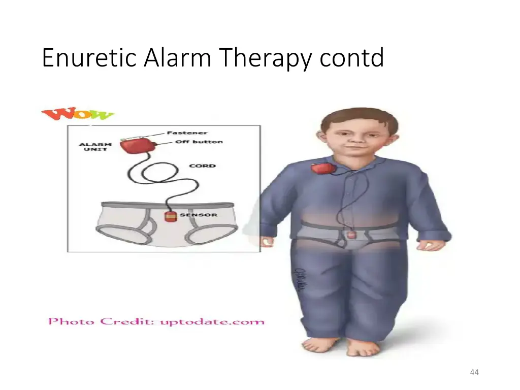 enuretic alarm therapy contd