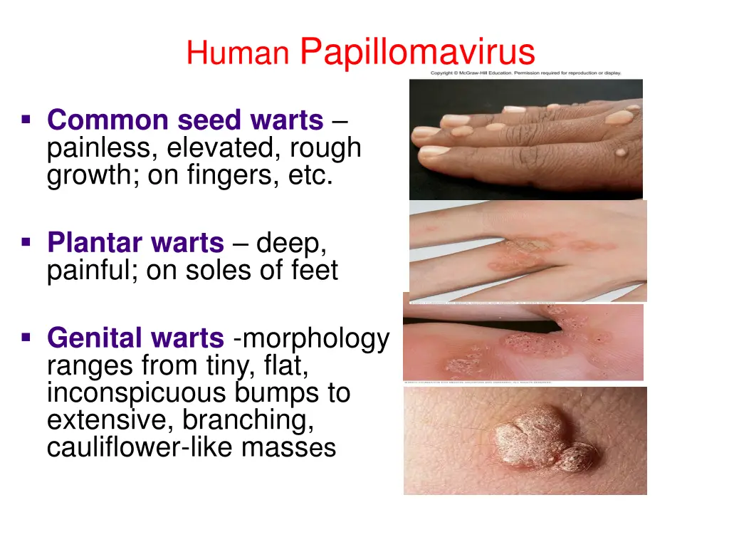 human papillomavirus 1