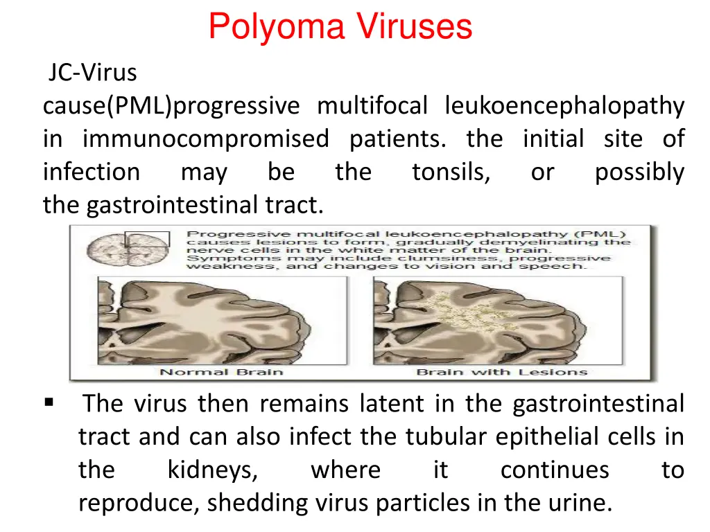 polyoma viruses 2