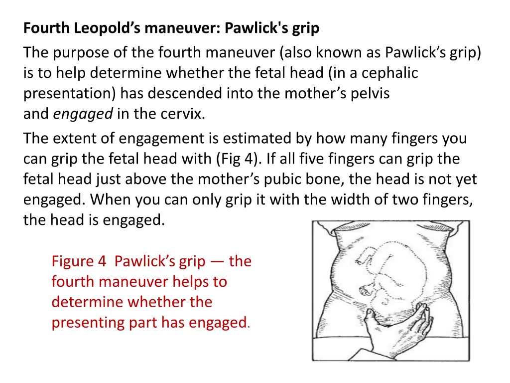 fourth leopold s maneuver pawlick s grip