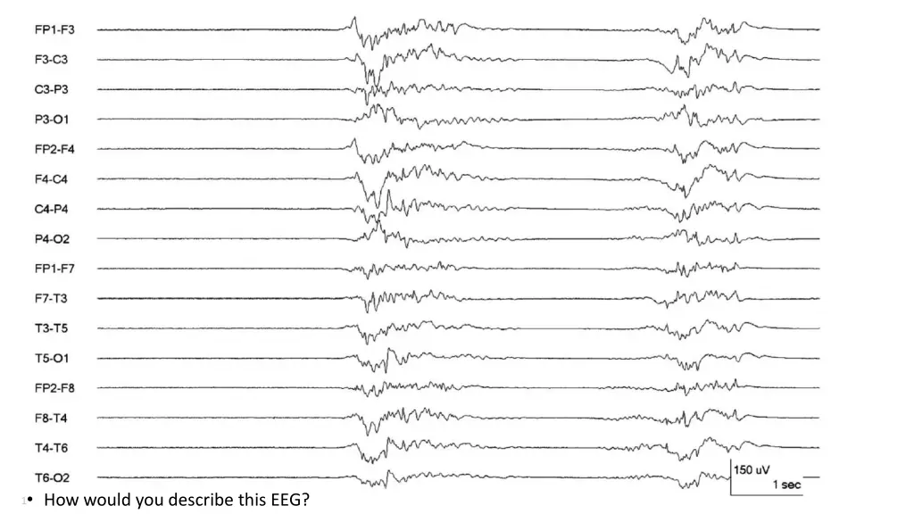 16 how would you describe this eeg