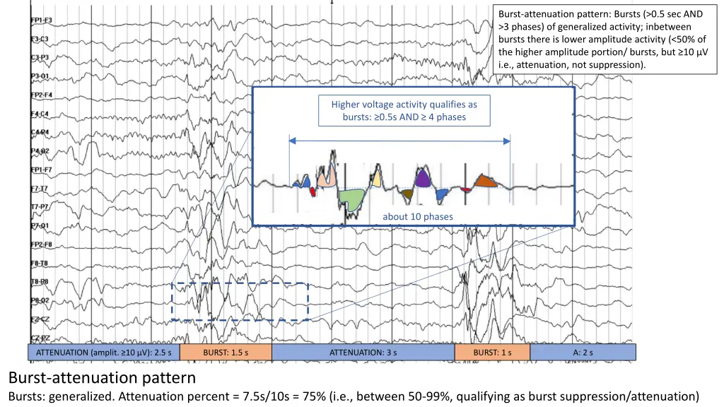 burst attenuation pattern bursts