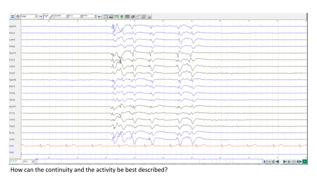 how can the continuity and the activity be best