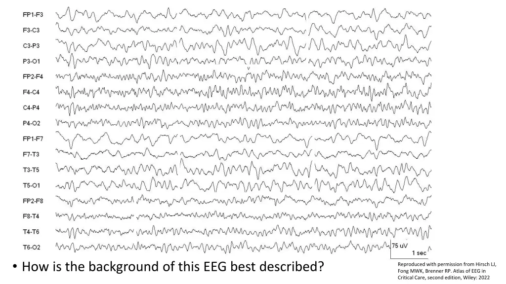 how is the background of this eeg best described 1