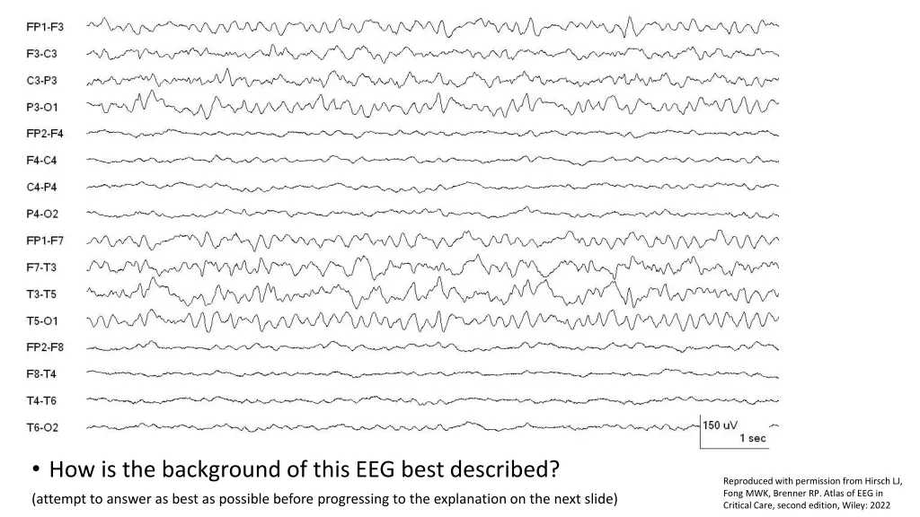 how is the background of this eeg best described