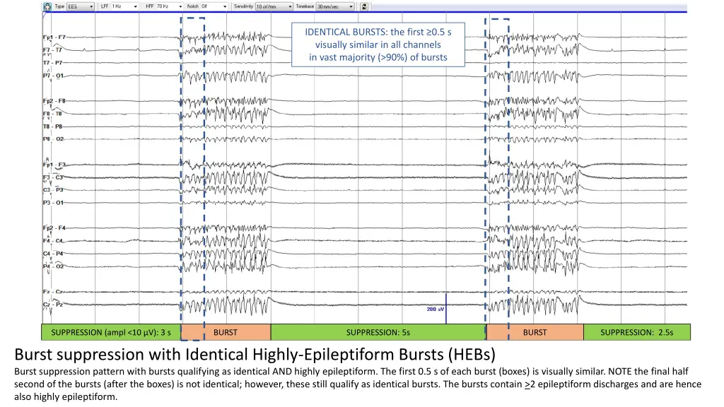 identical bursts the first 0 5 s visually similar