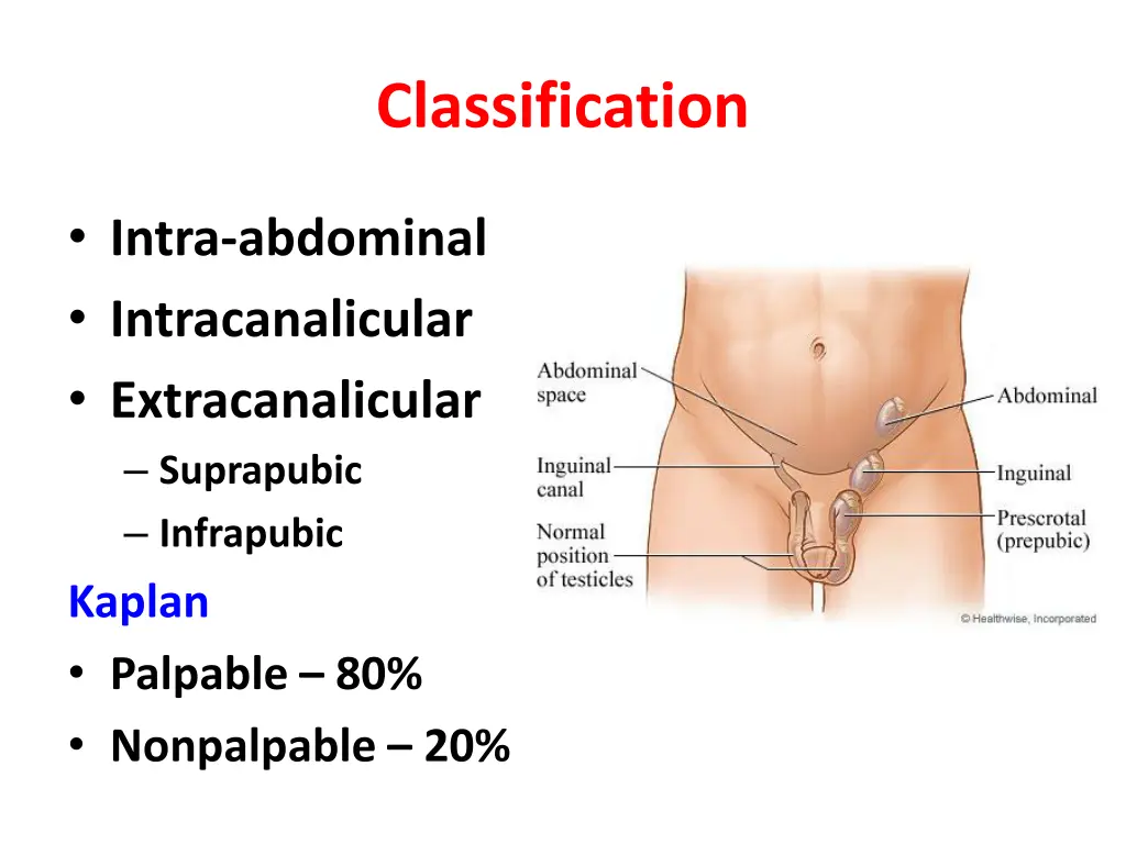 classification