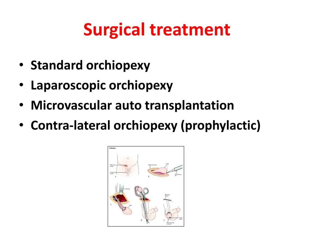 surgical treatment