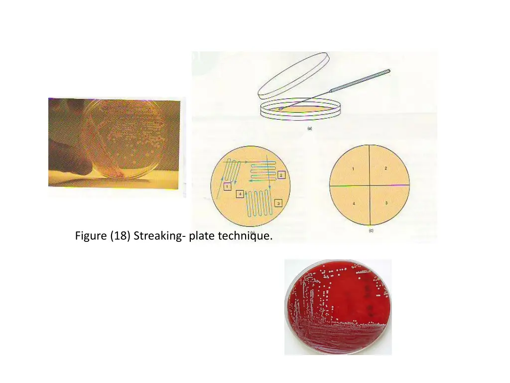 figure 18 streaking plate technique